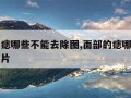 面部的痣哪些不能去除图,面部的痣哪些不能去除图片